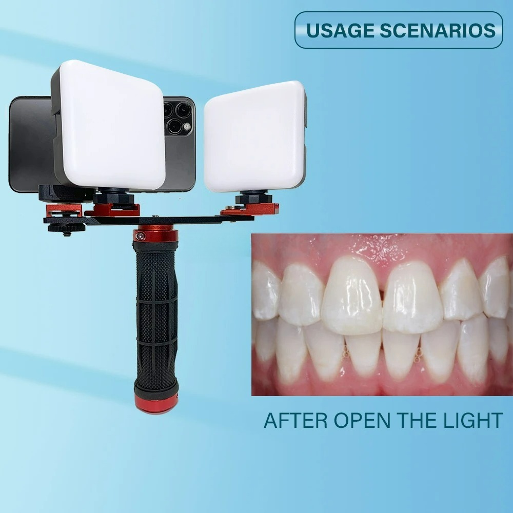 Dental Photography Light Phone - Photography Lighting Accessories ulasan dan harga