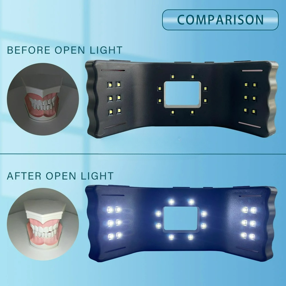 Dental Photography Light Phone - Photography Lighting Accessories ulasan dan harga